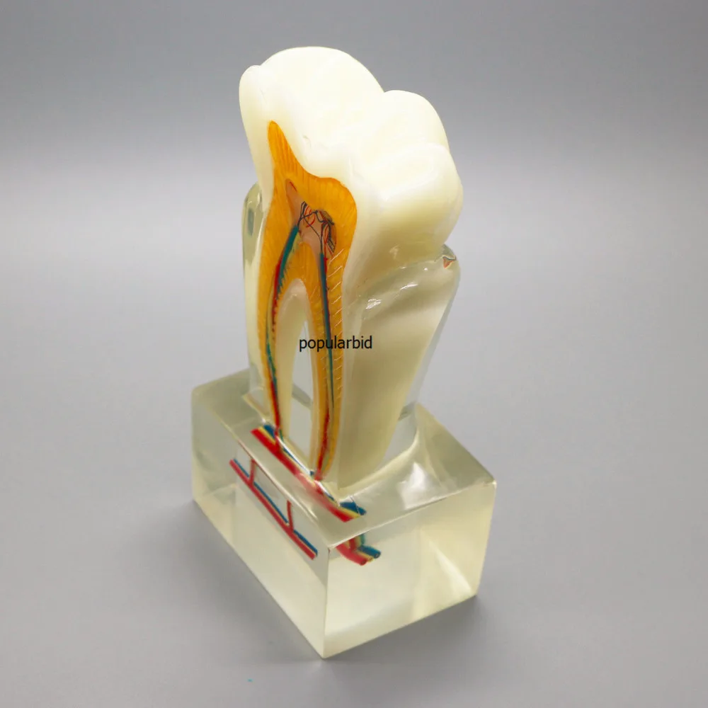 Orthodontic model 6:1 teeth Teaching with clear base nerve anatomical dissection demonstration Dentist endodontics - Image 5