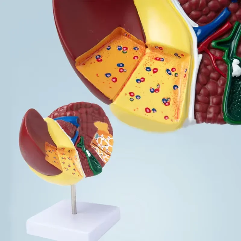 Pathological Liver Anatomical Model 1:1 Human Liver Model Anatomy Display for Medical School Study and Research - Image 2
