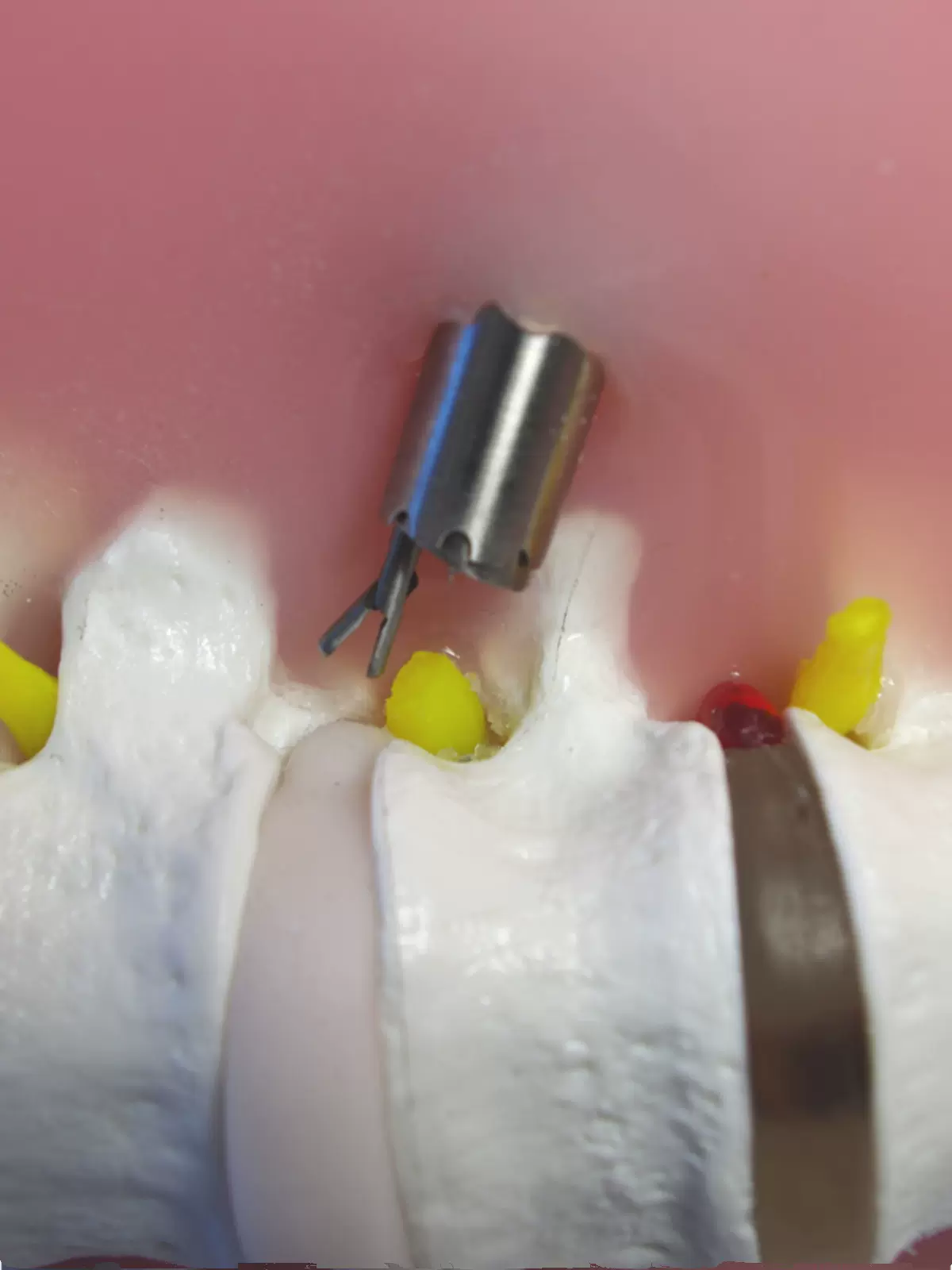 Percutaneous Transforaminal Endoscopic Discectomy Pted Training Model Human Back Model Soft And Punctureable - Image 2