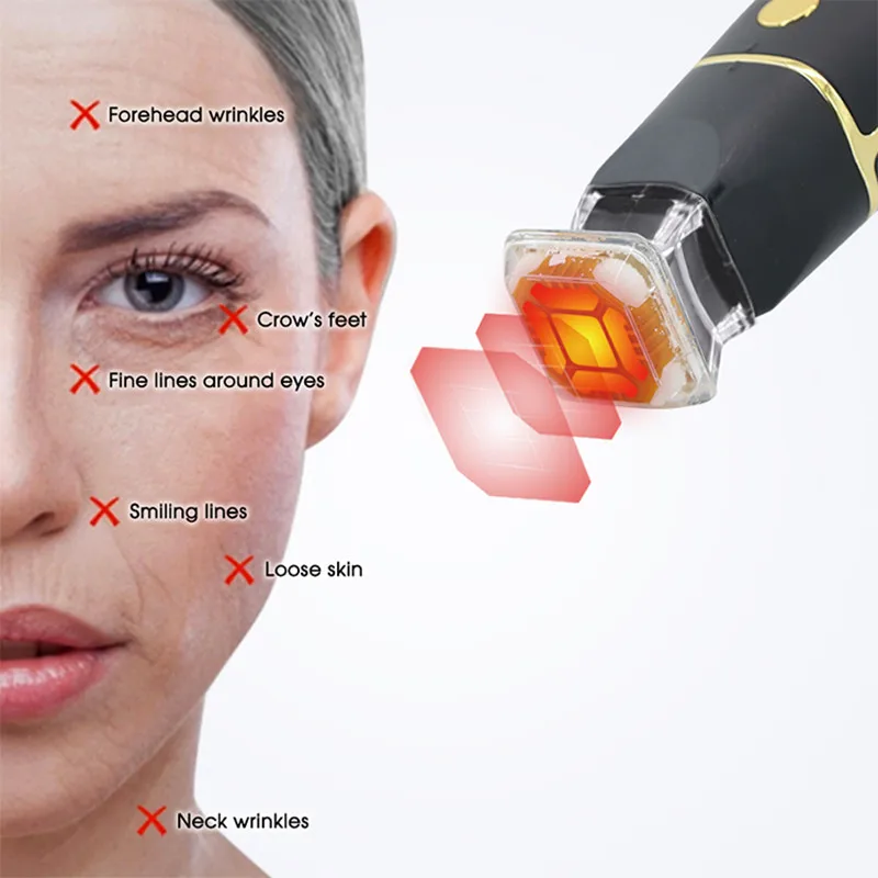 Portable RF Thermal Lifting Tightening Machine cellulite removal High Frequency Radio Anti Wrinkle Aging Skin Rejuvenation Tool - Image 4