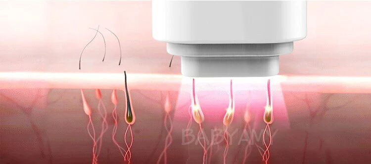 Profession 6 in 1 laser Hair Removal Whole Body Bikini laser Permanent Hair Removal laser Epilator Device Flashes PRECISION PLUS - Image 4