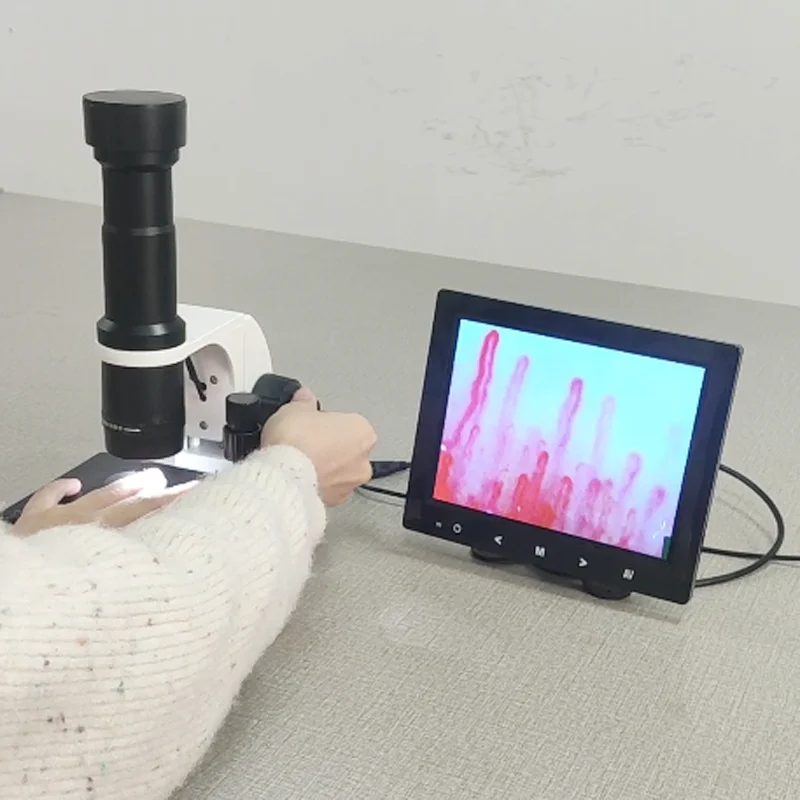 Professional Capillaroscope 9 Inch Monitor Nailfold Capillaroscopy Microcirculation Test Machine - Image 4