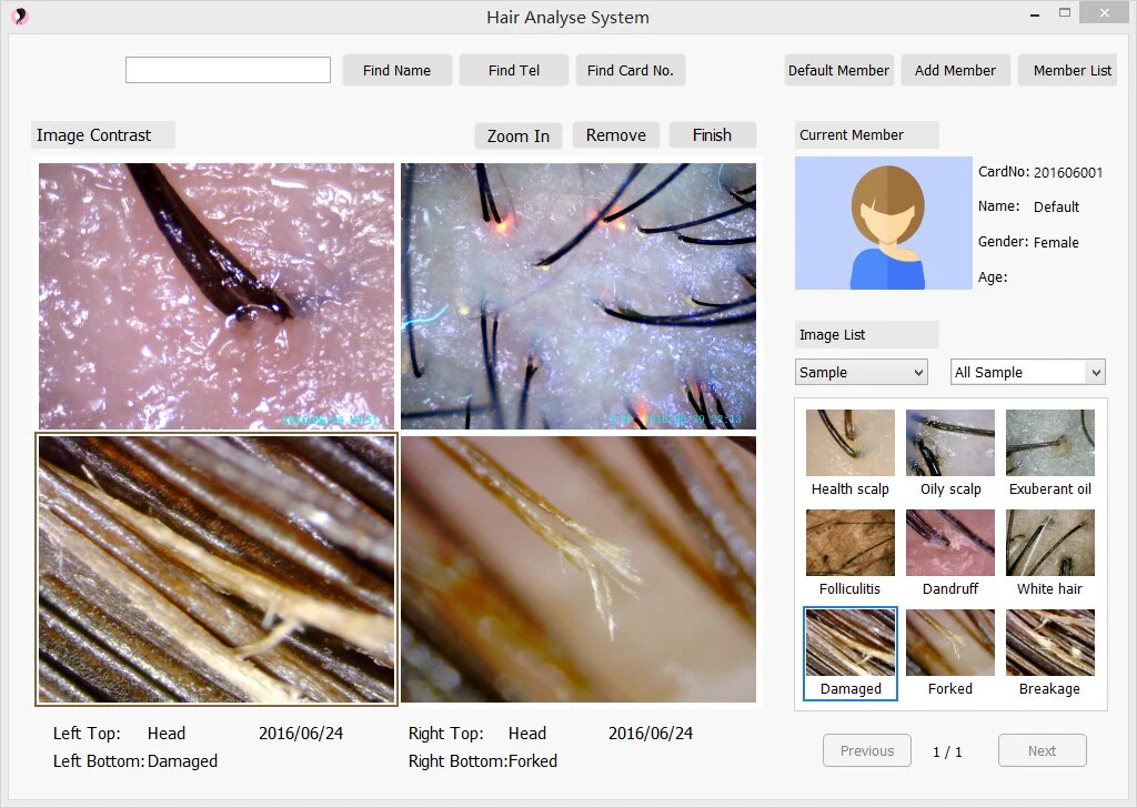 Professional Hair and Scalp Analysis Device Hair Analyzer Machine With Member Management Storage - Image 5