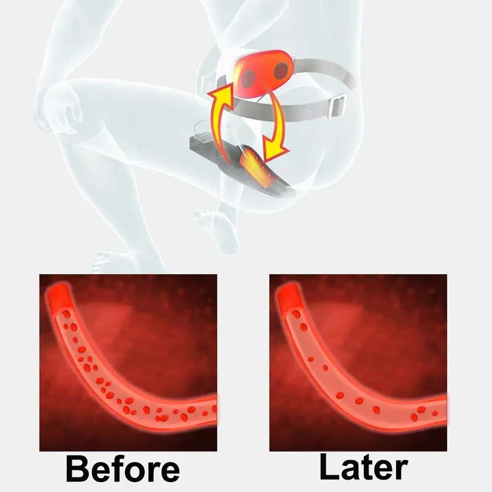 Prostate Massage Treatment Apparatus Infrared Heat Therapy Physiotherapy Prostate Calcification Treatment - Image 2
