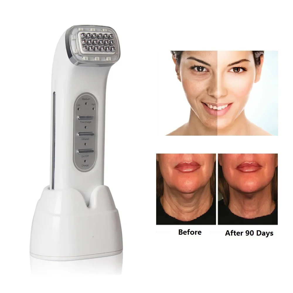 Radiofrequency Facial RF Radio Frequency Lifting Face Lift Body SKin anti Wrinkle Removal Skin Tightening Beauty - Image 2