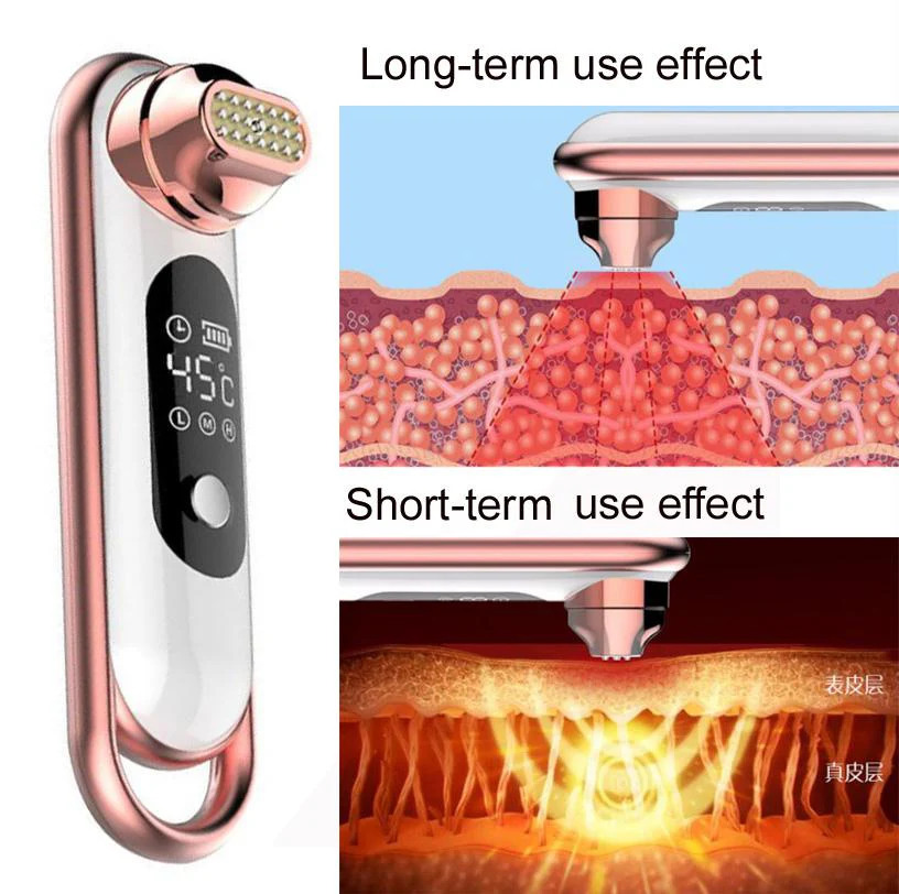 RF Wrinkle Removal Beauty Machine Dot Matrix Facial Thermage Radio Frequency Face Lifting Skin Tightening RF Thermage Skin Sare - Image 6