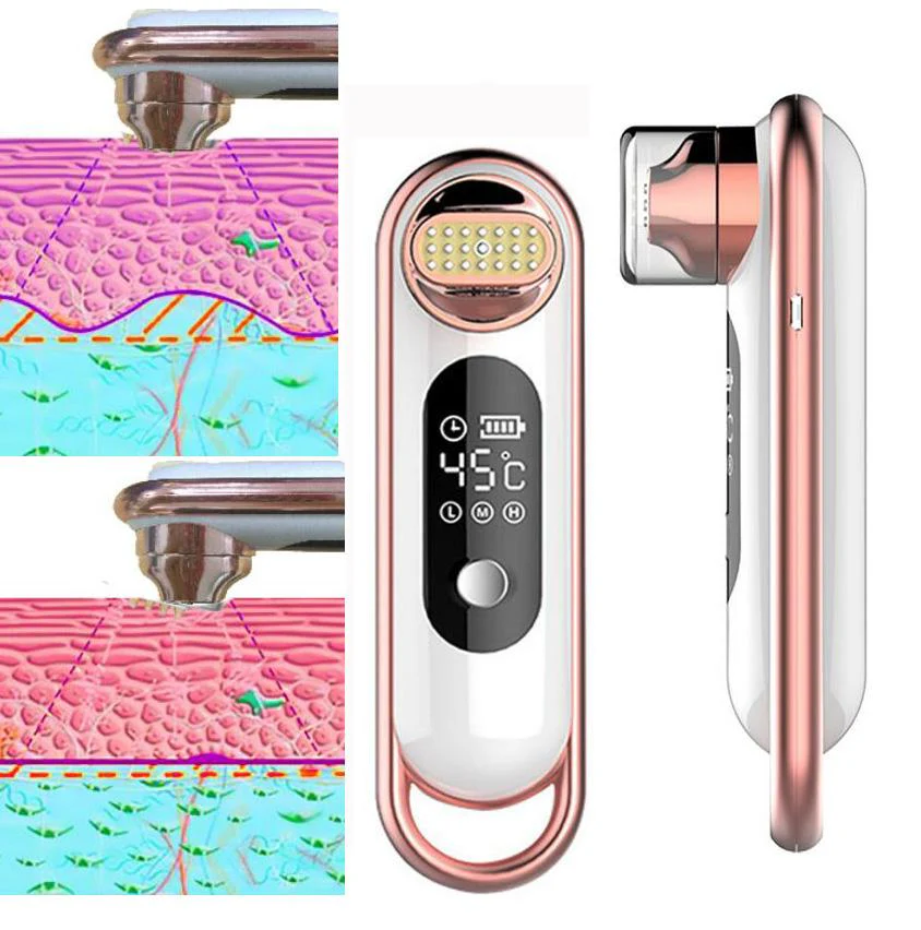 RF Wrinkle Removal Beauty Machine Dot Matrix Facial Thermage Radio Frequency Face Lifting Skin Tightening RF Thermage Skin Sare - Image 8