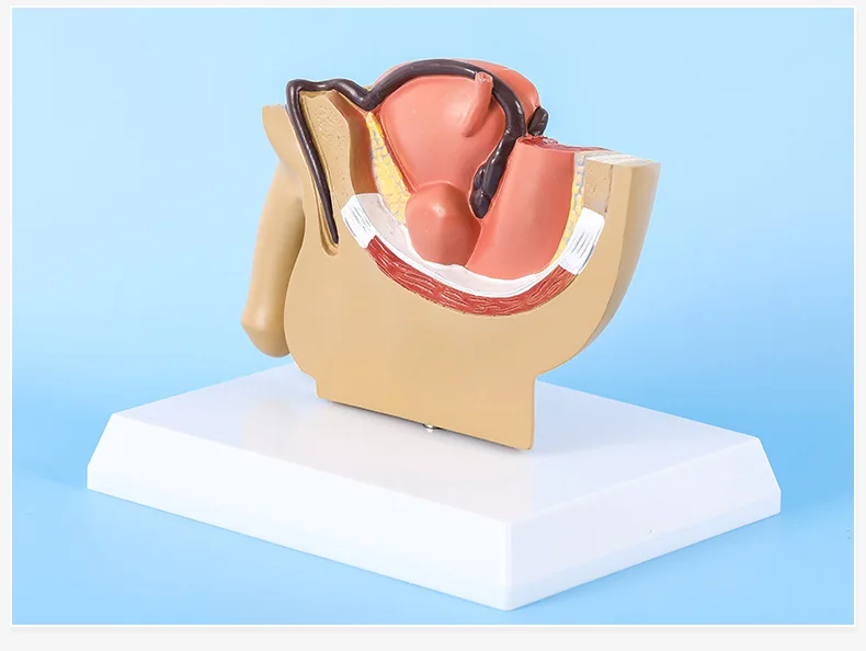 Sagittal Pelvic Anatomy Model Male And Female Male Reproductive Organ Model Reproductive System Model Medical Teaching Supplies - Image 3