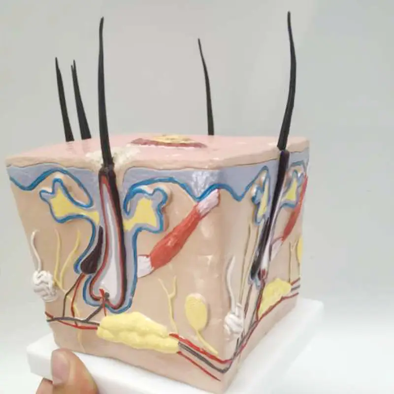 Scalp model hair loss hair transplant hair follicle inflammation capillary nerve teaching model - Image 4
