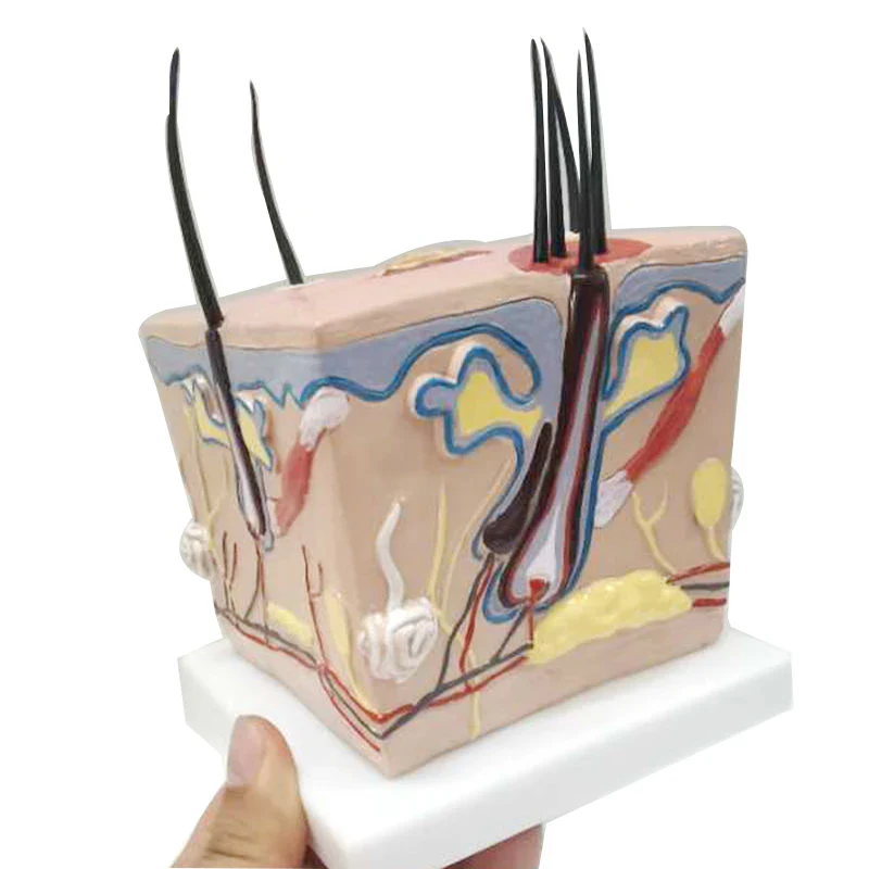 Scalp model hair loss hair transplant hair follicle inflammation capillary nerve teaching model - Image 5