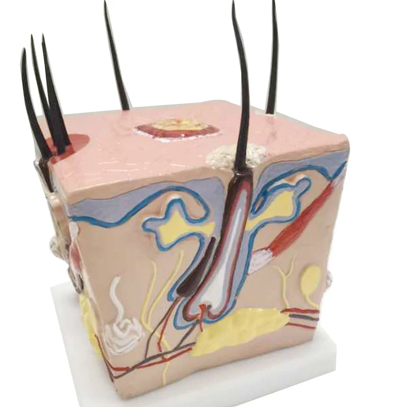 Scalp model hair loss hair transplant hair follicle inflammation capillary nerve teaching model - Image 6