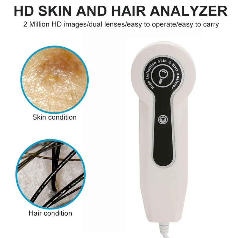 Skin Analyzer 7 inch 50X/200X Magnifying Scepter Analyzer 500W HD Skin Scanner Hair Follicle Oil Moisture Pigment Tester Scalp - Image 3