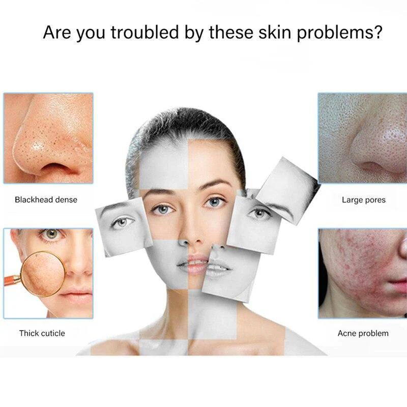 Skin Beauty Cleansing Facial Bubble Machine Vacuum suction Facial Cleansing Device for Clean pores remove blackheads 8 tips - Image 3