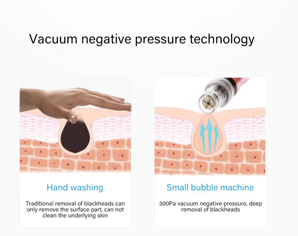 Skin Beauty Cleansing Facial Bubble Machine Vacuum suction Facial Cleansing Device for Clean pores remove blackheads 8 tips - Image 7