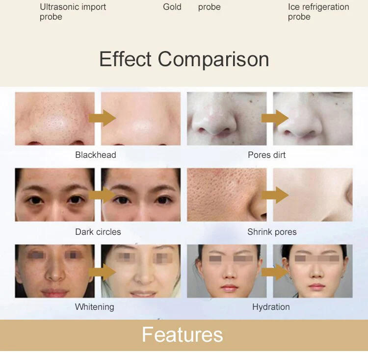 Smart Ice Blue Magic Mirror Skin Analyzer Face Lifting Microdermoabrasion Oxygen Sprayer Hydrodermabrasion Deep cleaning Machine - Image 9