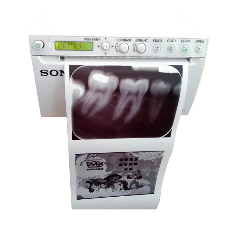 UP-X898MD Medical 3D 4D Doppler Ultrasound Video Printer Price Portable Thermal Printer For Veterinary Ultrasound - Image 6