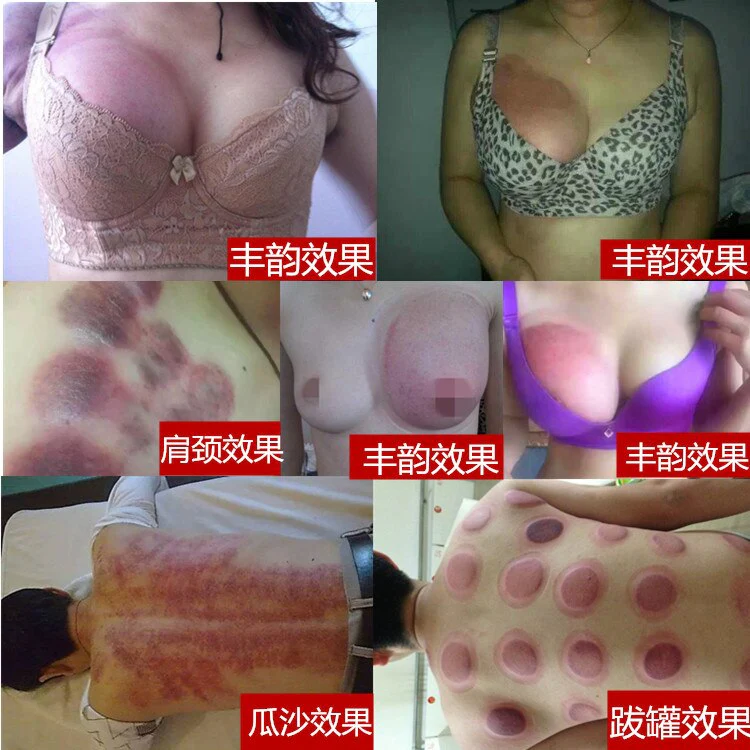 Vacuum Breast Enhancement Cupping Therapy Cups Set Breast Enlarge Pump Breast Massager - Image 2