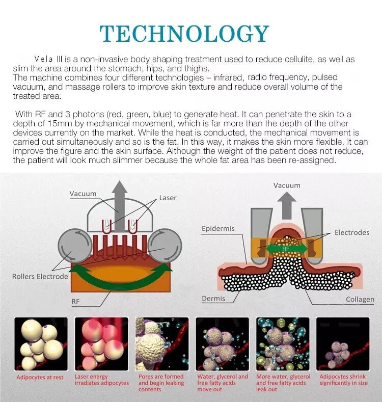 VelaShape Machine Transform Your Body with Advanced Non-Invasive Technology for Weight Loss and Fat Reduction - Image 7