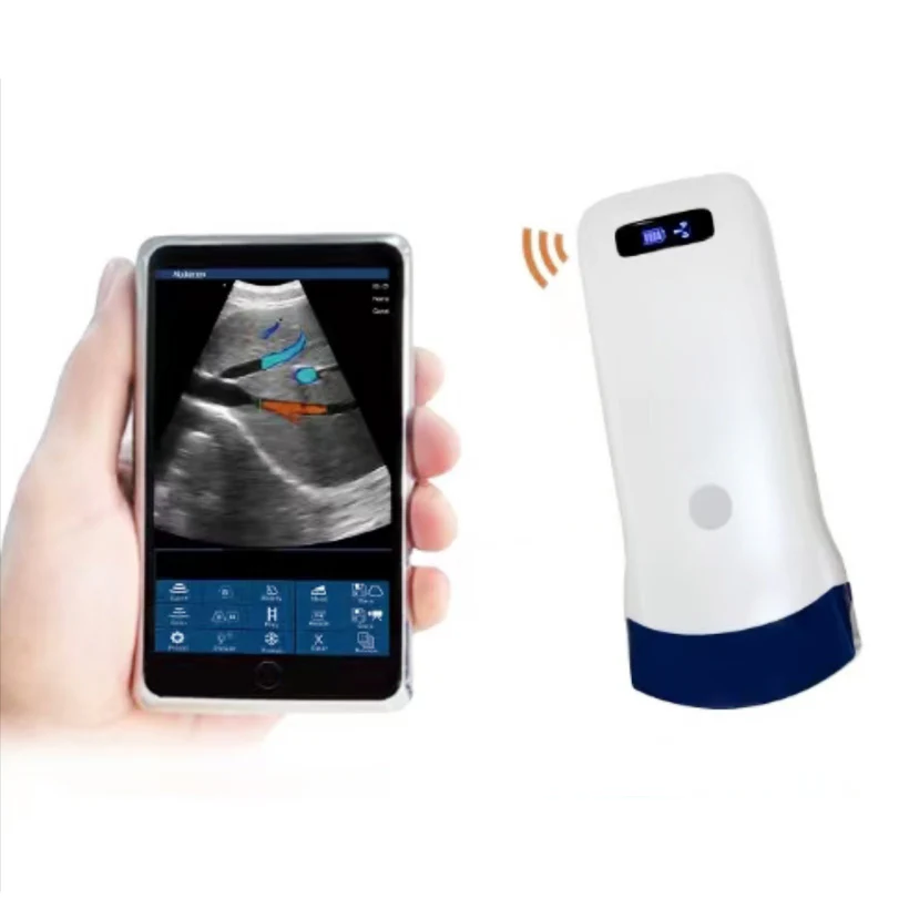 Wireless Ultrasound Probe WIFI Probe Convex / Linear Support ISO Andriod Portable Wifi-Scanner 3.5Mhz / 7.5Mhz - Image 12