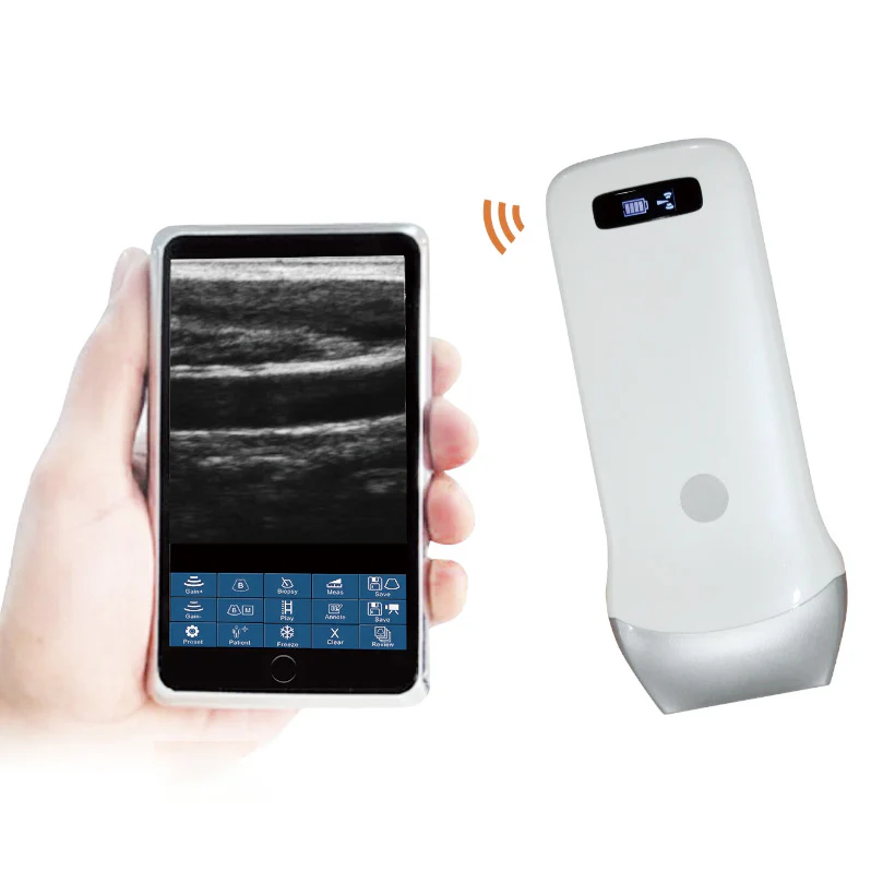 Wireless Ultrasound Probe WIFI Probe Convex / Linear Support ISO Andriod Portable Wifi-Scanner 3.5Mhz / 7.5Mhz - Image 7