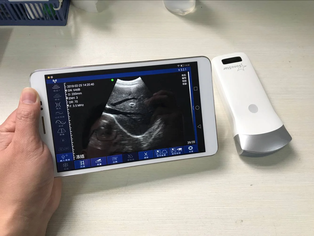 Wireless Ultrasound Probe WIFI Probe Convex / Linear Support ISO Andriod Portable Wifi-Scanner 3.5Mhz / 7.5Mhz - Image 8