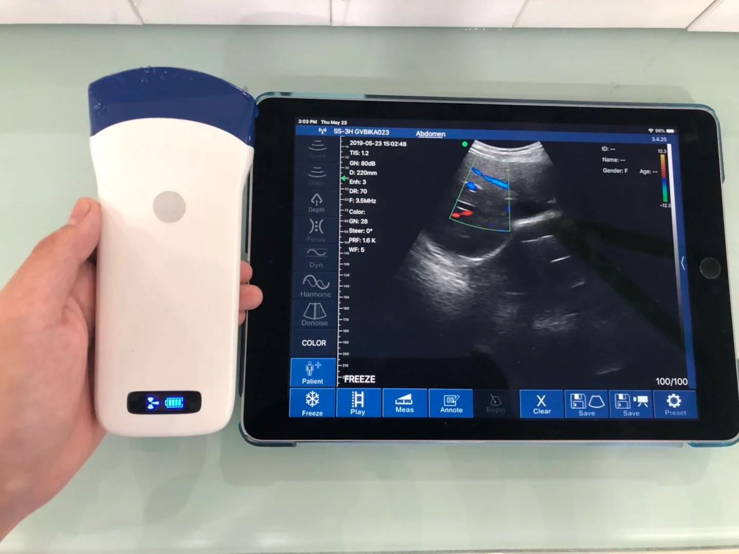Wireless Ultrasound Probe WIFI Probe CProbe-5C Color Doppler128E Convex Support ISO Andriod Portable Wifi-Scanner 3.2Mhz / 5Mhz - Image 3