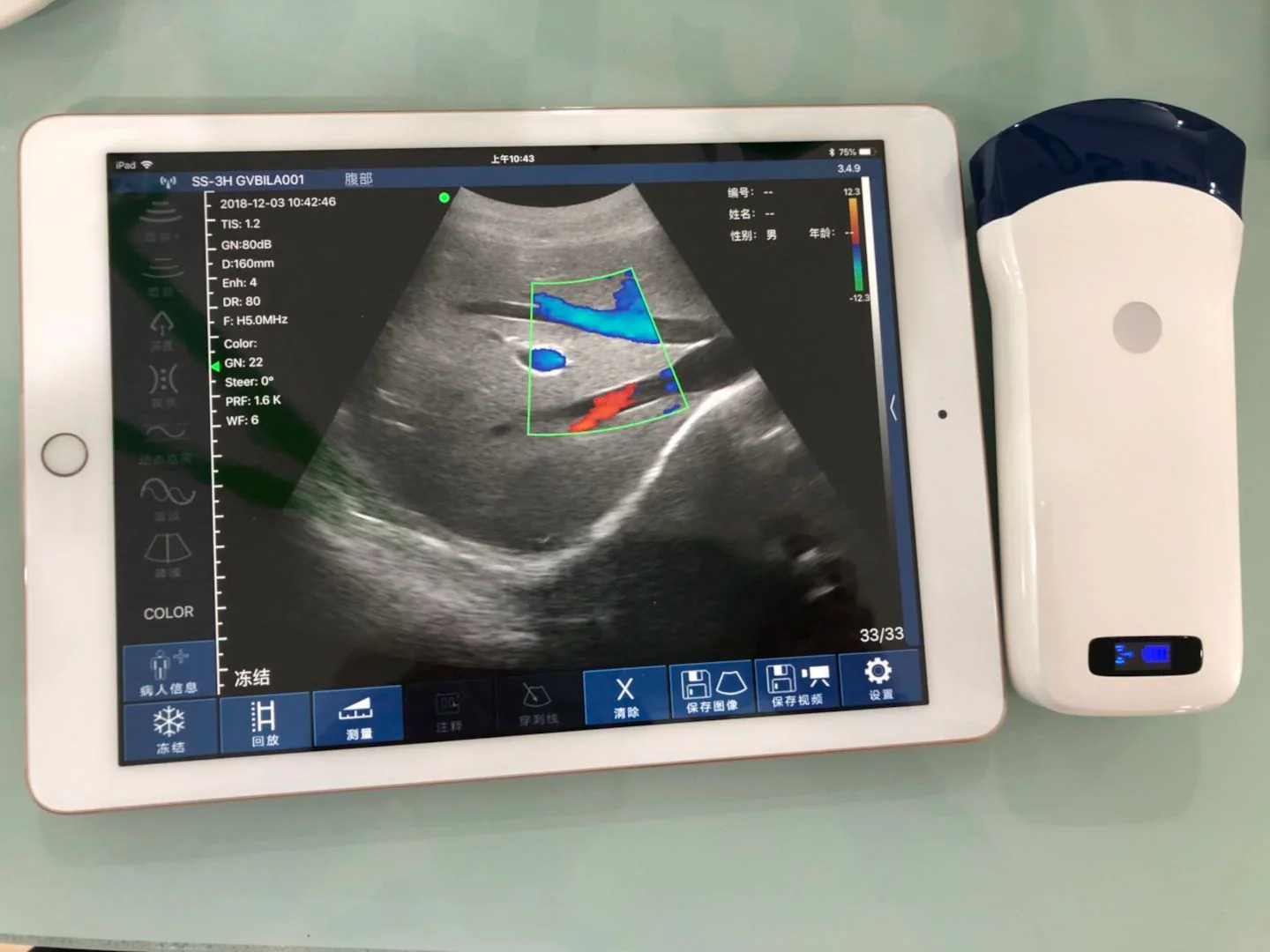 Wireless Ultrasound Probe WIFI Probe CProbe-5C Color Doppler128E Convex Support ISO Andriod Portable Wifi-Scanner 3.2Mhz / 5Mhz - Image 4