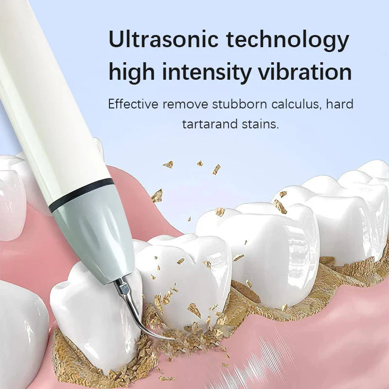 Woodpecker DTE D7 Dental Ultrasonic Scaler Oral Irrigator Tartar Removal Automatic Water Supply Cleansing Machine - Image 4