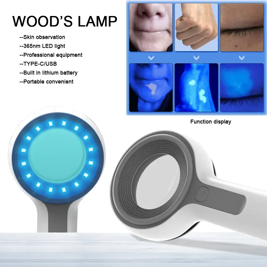 Woods Lamp Skin Analyzer For Skin UV Magnifying For Beauty Facial Testing Wood Lamp Light Skin Analysis Detection Personal Care - Image 2